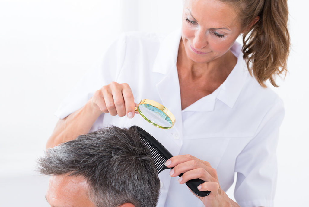 alopecia-areata