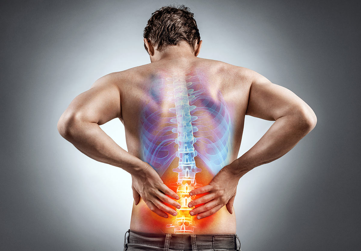 espondilitis-anquilosante-sintomas