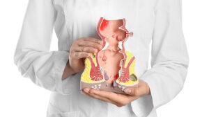 Tipos de hemorroides y tratamientos
